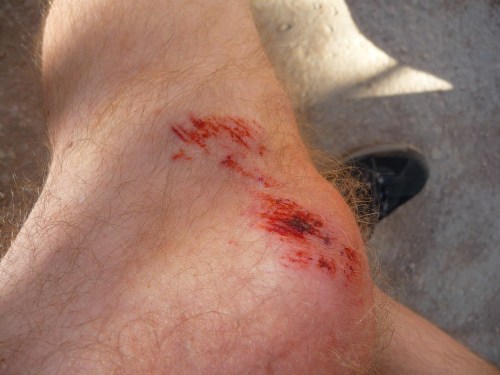 Camp Host Chad_Camping Boo Boo